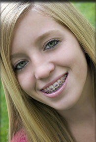 stock photo of a teen girl with braces